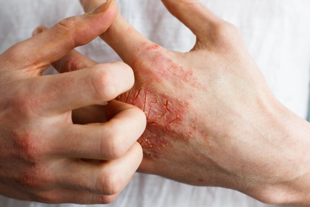 naturopathic doctor for skin issues in Scottsdale, AZ.