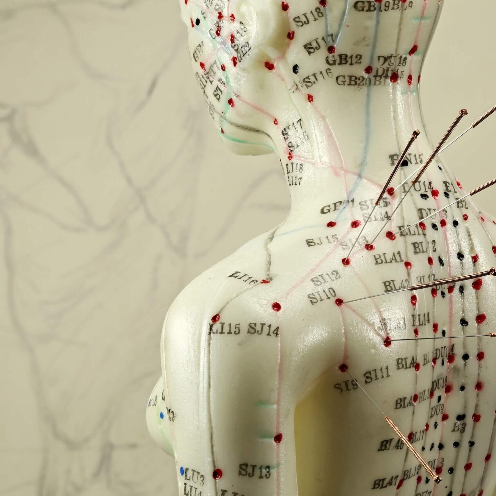 acupuncture specialist in Scottsdale.